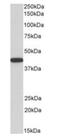 Alpha-Methylacyl-CoA Racemase antibody, orb195338, Biorbyt, Western Blot image 