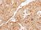 Cell Death Inducing DFFA Like Effector C antibody, NBP2-15902, Novus Biologicals, Immunohistochemistry frozen image 