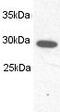 Proteasome Subunit Alpha 1 antibody, ab3325, Abcam, Western Blot image 