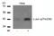 Jun Proto-Oncogene, AP-1 Transcription Factor Subunit antibody, PA5-37619, Invitrogen Antibodies, Western Blot image 