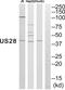 Cytomegalovirus US28 antibody, PA5-39864, Invitrogen Antibodies, Western Blot image 