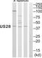 Cytomegalovirus US28 antibody, PA5-39864, Invitrogen Antibodies, Western Blot image 