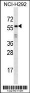 Outer Dense Fiber Of Sperm Tails 2 Like antibody, 56-796, ProSci, Western Blot image 