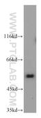 Nucleoporin 50 antibody, 20798-1-AP, Proteintech Group, Western Blot image 