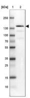 Tim1 antibody, NBP2-32559, Novus Biologicals, Western Blot image 