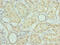 Protein Arginine Methyltransferase 6 antibody, A60418-100, Epigentek, Immunohistochemistry paraffin image 