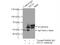 Metastasis Associated 1 Family Member 3 antibody, 14682-1-AP, Proteintech Group, Immunoprecipitation image 