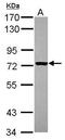 Interleukin 2 Receptor Subunit Beta antibody, PA5-29818, Invitrogen Antibodies, Western Blot image 