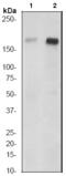 TSC Complex Subunit 2 antibody, TA303844, Origene, Western Blot image 