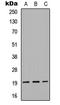 Gremlin 2, DAN Family BMP Antagonist antibody, LS-C356069, Lifespan Biosciences, Western Blot image 
