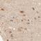 ATP Synthase F1 Subunit Delta antibody, NBP1-86162, Novus Biologicals, Immunohistochemistry frozen image 