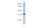 TIMELESS-interacting protein antibody, 30-640, ProSci, Western Blot image 