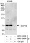 Decapping MRNA 1B antibody, NBP2-04009, Novus Biologicals, Immunoprecipitation image 