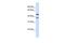 Transmembrane Protein 135 antibody, GTX45996, GeneTex, Western Blot image 