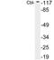 Cbl Proto-Oncogene antibody, LS-C199787, Lifespan Biosciences, Western Blot image 