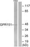 G Protein-Coupled Receptor 151 antibody, A30814, Boster Biological Technology, Western Blot image 