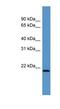 Actin Related Protein 2/3 Complex Subunit 4 antibody, NBP1-69003, Novus Biologicals, Western Blot image 