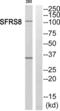 Splicing factor, suppressor of white-apricot homolog antibody, abx014925, Abbexa, Western Blot image 