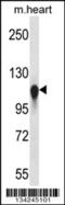 Kinesin Family Member 5C antibody, 57-776, ProSci, Western Blot image 