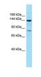 Glucokinase Regulator antibody, orb331241, Biorbyt, Western Blot image 