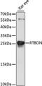 Retbindin antibody, 16-090, ProSci, Western Blot image 