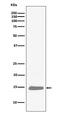 Hemoglobin Subunit Alpha 2 antibody, M00233, Boster Biological Technology, Western Blot image 