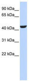 Retinol Dehydrogenase 16 antibody, TA346360, Origene, Western Blot image 