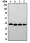 Folate Receptor Alpha antibody, LS-C352204, Lifespan Biosciences, Western Blot image 