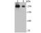 Pre-MRNA Processing Factor 8 antibody, A02878-1, Boster Biological Technology, Western Blot image 