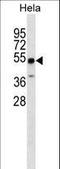 Zinc Finger And SCAN Domain Containing 4 antibody, LS-C157528, Lifespan Biosciences, Western Blot image 