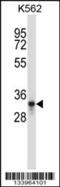 Pancreas Associated Transcription Factor 1a antibody, 57-324, ProSci, Western Blot image 