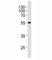 Pyruvate Dehydrogenase Complex Component X antibody, F47891-0.4ML, NSJ Bioreagents, Western Blot image 