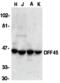 DNA Fragmentation Factor Subunit Alpha antibody, 2409, QED Bioscience, Western Blot image 