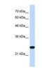 Transmembrane Protein 109 antibody, NBP1-91346, Novus Biologicals, Western Blot image 