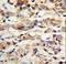 Keratin 14 antibody, LS-C165617, Lifespan Biosciences, Immunohistochemistry frozen image 