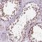 O-6-Methylguanine-DNA Methyltransferase antibody, NBP2-68885, Novus Biologicals, Immunohistochemistry paraffin image 