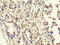 MAGE-3 antigen antibody, CSB-PA013329LA01HU, Cusabio, Immunohistochemistry paraffin image 