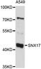 Sorting Nexin 17 antibody, STJ112312, St John