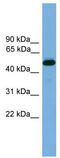 Thyroid Hormone Receptor Beta antibody, TA341822, Origene, Western Blot image 