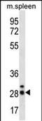 Calcium And Integrin Binding Family Member 4 antibody, PA5-48402, Invitrogen Antibodies, Western Blot image 