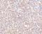 STEAP Family Member 1 antibody, A07506, Boster Biological Technology, Immunohistochemistry paraffin image 