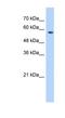 Splicing Factor 3a Subunit 3 antibody, NBP1-57424, Novus Biologicals, Western Blot image 