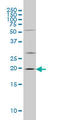 Crystallin Alpha B antibody, LS-C196970, Lifespan Biosciences, Western Blot image 