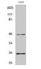 Transforming Growth Factor Beta 3 antibody, STJ95999, St John