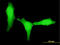 Zinc Finger E-Box Binding Homeobox 1 antibody, LS-C198314, Lifespan Biosciences, Immunofluorescence image 