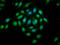 Ephrin type-A receptor 2 antibody, LS-C670113, Lifespan Biosciences, Immunofluorescence image 