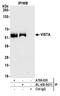 Platelet receptor Gi24 antibody, A700-035, Bethyl Labs, Immunoprecipitation image 