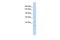 NEDD4-like E3 ubiquitin-protein ligase WWP1 antibody, PA5-42293, Invitrogen Antibodies, Western Blot image 