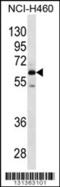 Matrix Extracellular Phosphoglycoprotein antibody, 56-396, ProSci, Western Blot image 