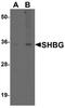 Sex Hormone Binding Globulin antibody, A00682, Boster Biological Technology, Western Blot image 